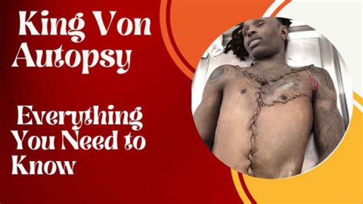 Preview: King Von Autopsy Photos In Detail | Unreleased