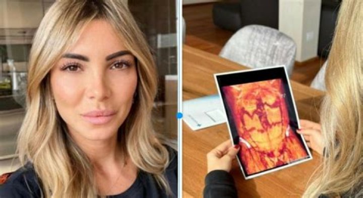 Noemi Bocchi Malattia: The Journey Of Strength And Resilience